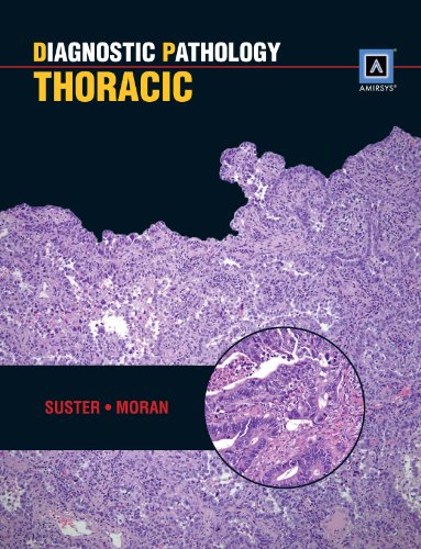 Diagnostic Pathology(t): Thoracic: Published by Amirsys(r)