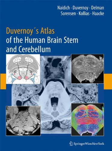 Duvernoy s Atlas of the Human Brain Stem and Cerebellum: High-Field MRI, Surface Anatomy, Internal Structure, Vascularization and 3 D Sectional Anatomy