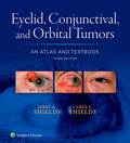 Eyelid, Conjunctival, and Orbital Tumors: An Atlas and Textbook