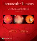 Intraocular Tumors: An Atlas and Textbook