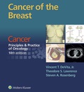 Cancer of the Breast