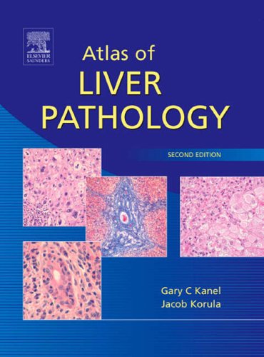 Atlas of Liver Pathology (ATLAS OF SURGICAL PATHOLOGY)