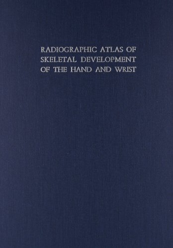 Radiographic Atlas of Skeletal Development of the Hand and Wrist